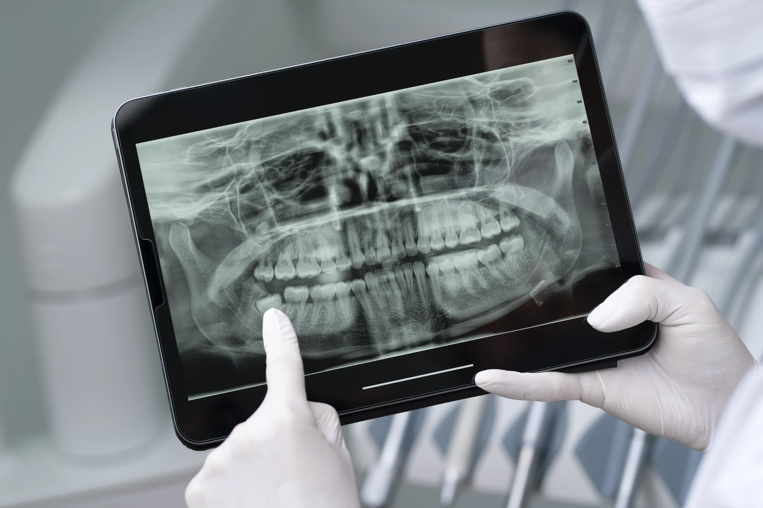 Radiografía panorámica dental digital en Vilcor, San Borja